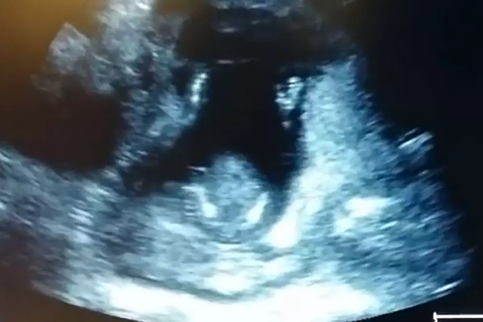 Baby Clapping On Ultrasound