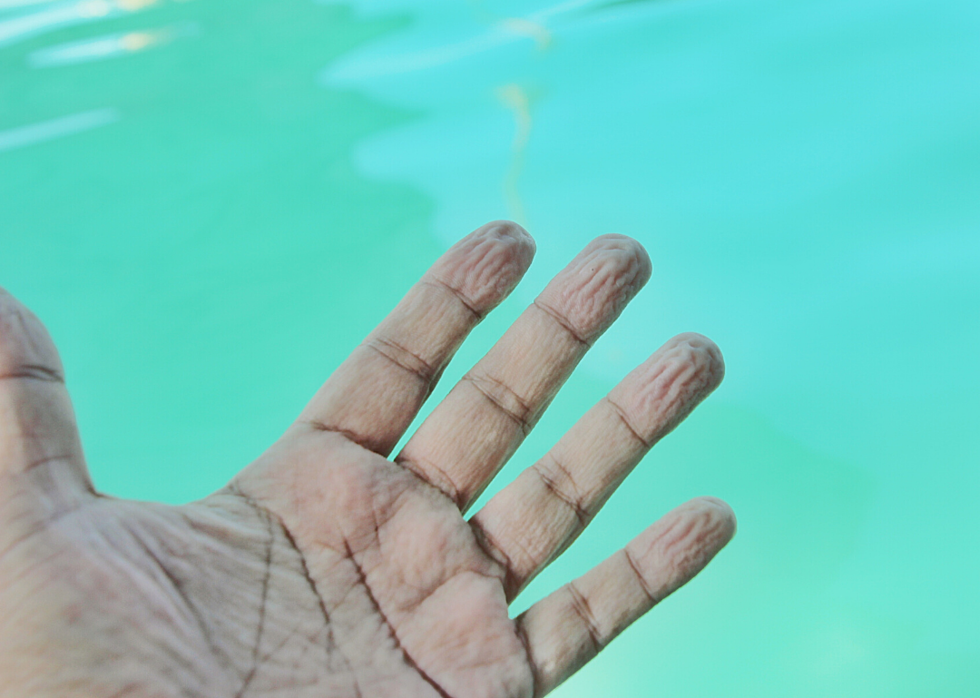 EXPLAINED: Wrinkled Fingers, Goosebumps and 13 Other Weird Body Quirks