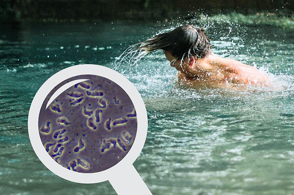 Nasty Brain-Eating Amoeba Indicated In Georgia Swimmer's Death