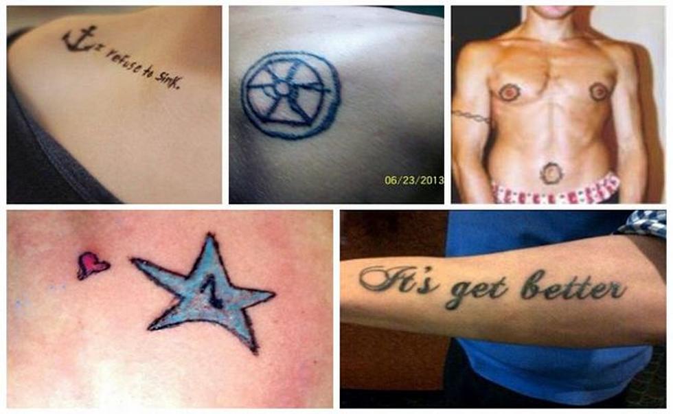 Enter 'Undo Your Tattoo'