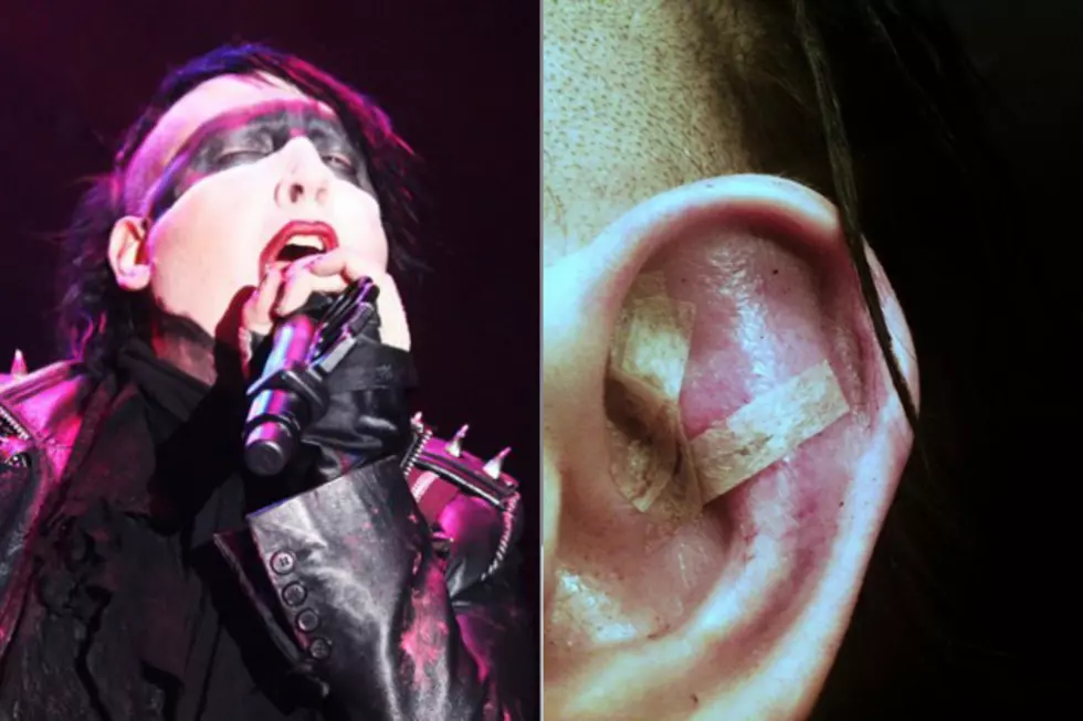 Marilyn Manson Requires 24 Stitches on His Ear Following Fight in Switzerland