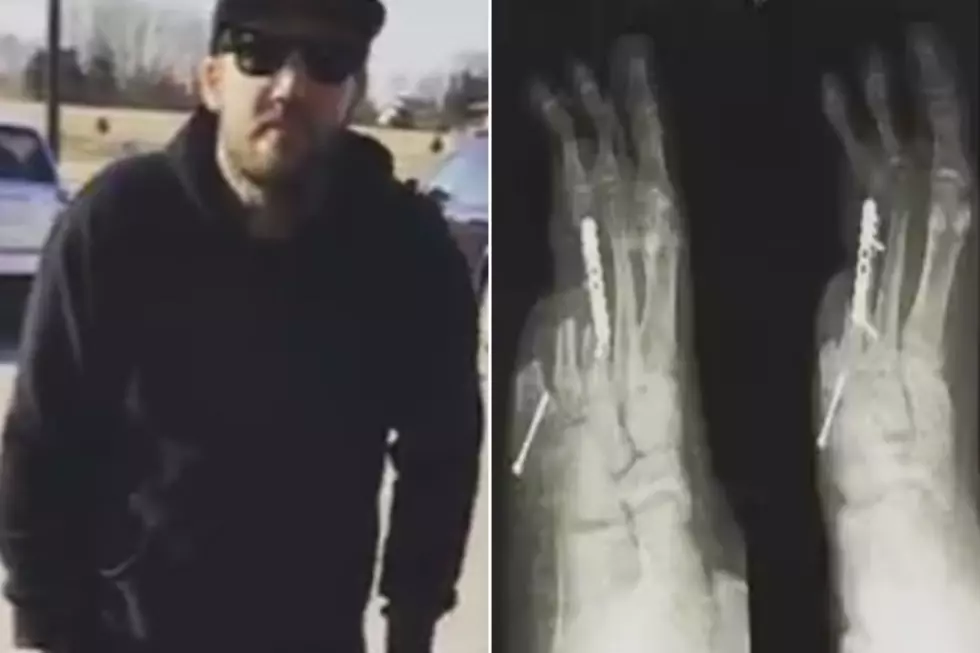 The Ghost Inside’s Zach Johnson Takes First Steps Since Losing Two Toes in Bus Crash