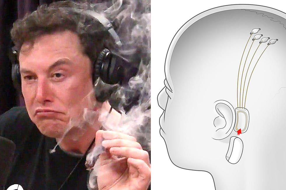 Elon Musk Wants to Make Headphones Obsolete, Plans Brain Chip for Blasting Music