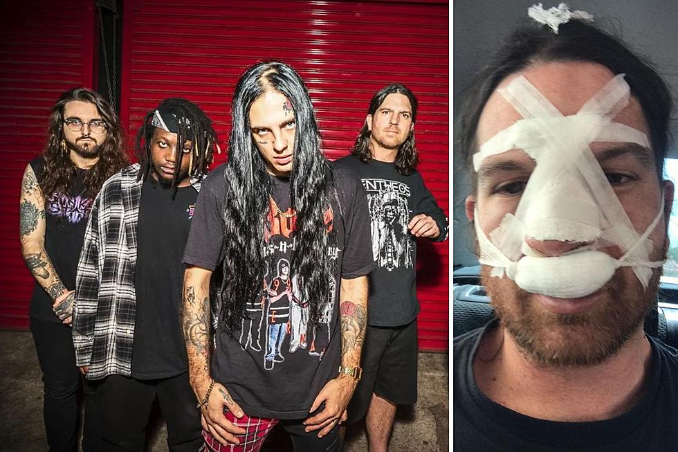 Vulvodynia Fire Vocalist After He ‘Tried to Kill’ Their Drummer, Share Photos of Injuries