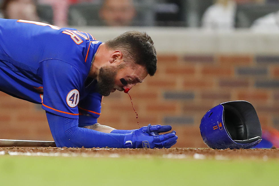 WATCH: Scary Moment as Mets OF Kevin Pillar Takes 94 MPH Fastball to Face