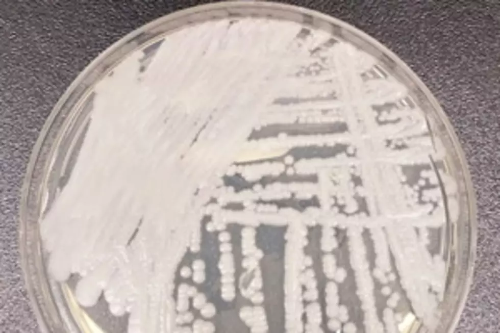 NJ researchers will work to curb a deadly fungal infection