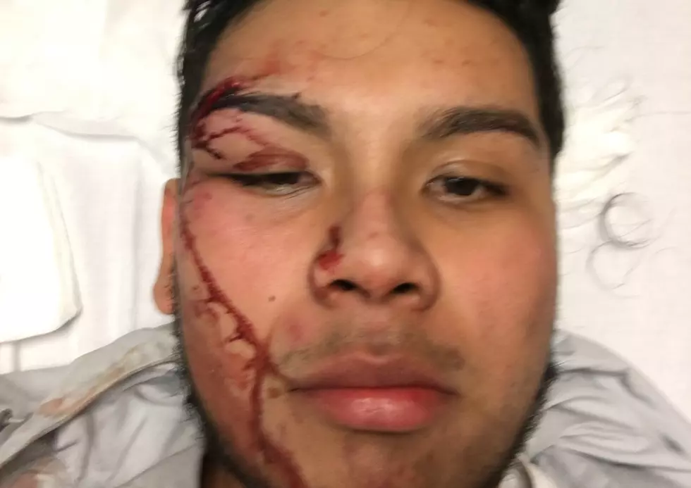 NJ teen suing after alleged beat-down by undercover cops