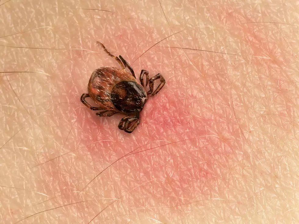 NJ in yearly &#8216;danger zone&#8217; for Lyme disease