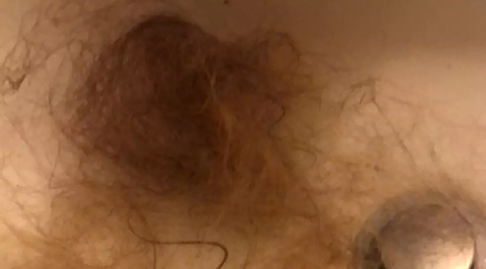 Rome Woman Loses Hair After Using Alleged Tainted shampoo