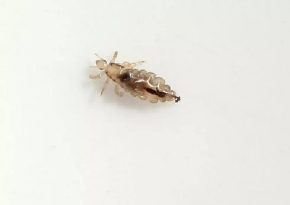Head Lice Cases Seeing Huge Increase During Pandemic