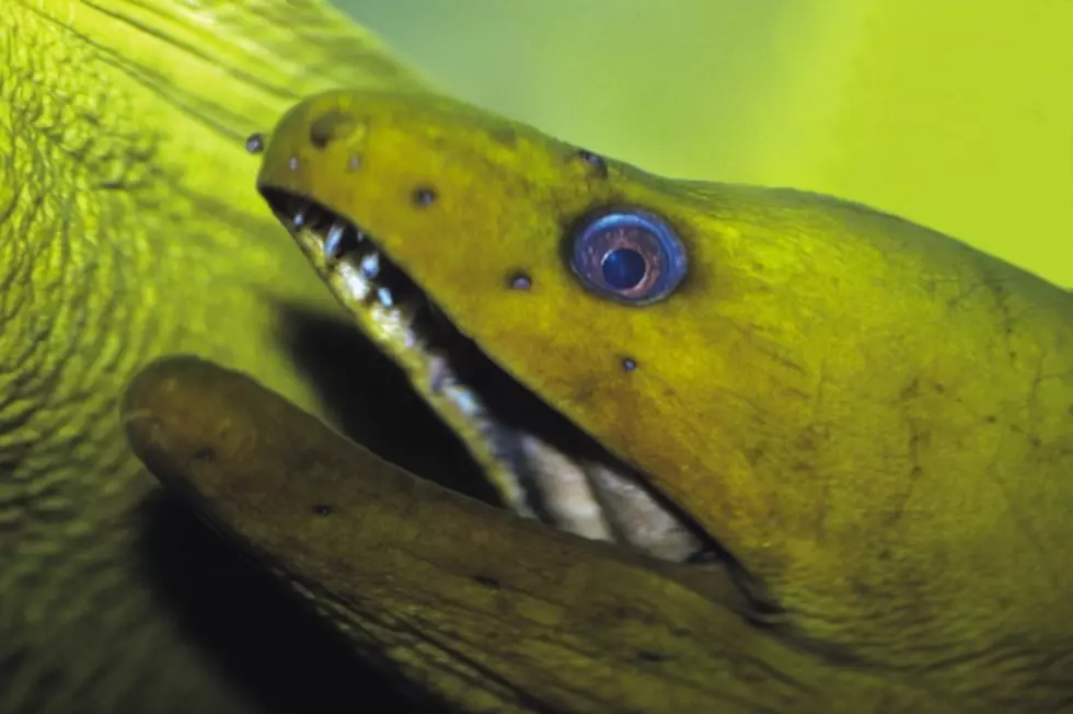 Eel Gets Lodged Up Guy’s Butt