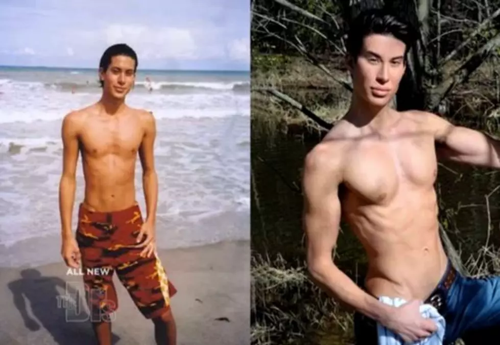Man Spends $100K to Look Like Real-Life Ken Doll