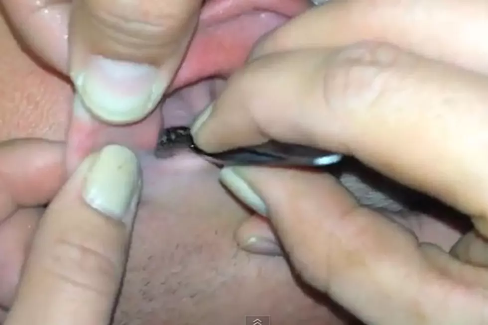 Guy Has Moth in Ear…But That’s Not the Worst Thing Stuck in There