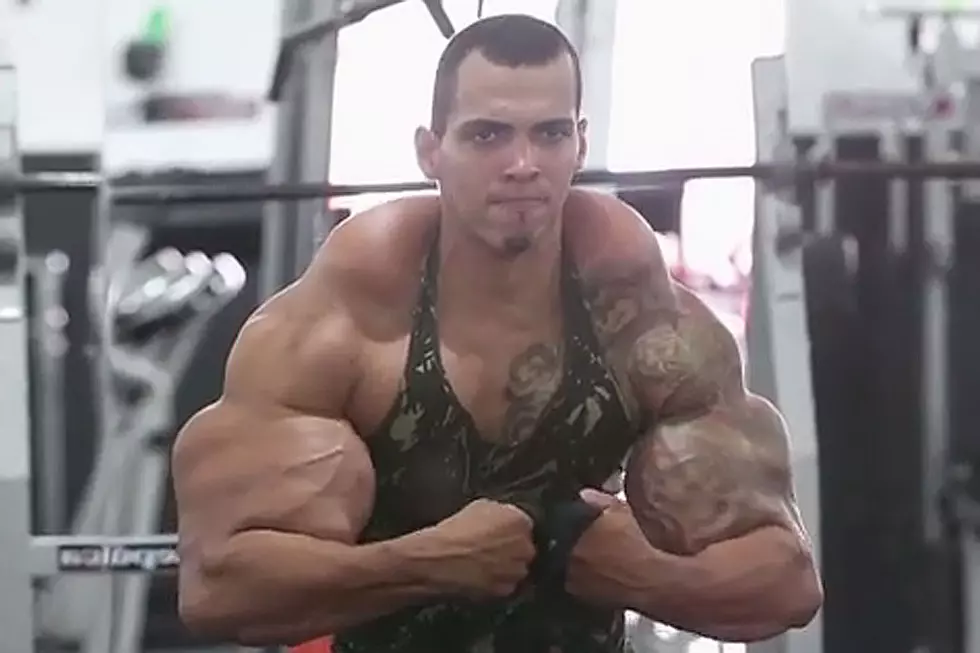 Man Desperate to Be a Real-Life Hulk Nearly Has Both Arms Amputated