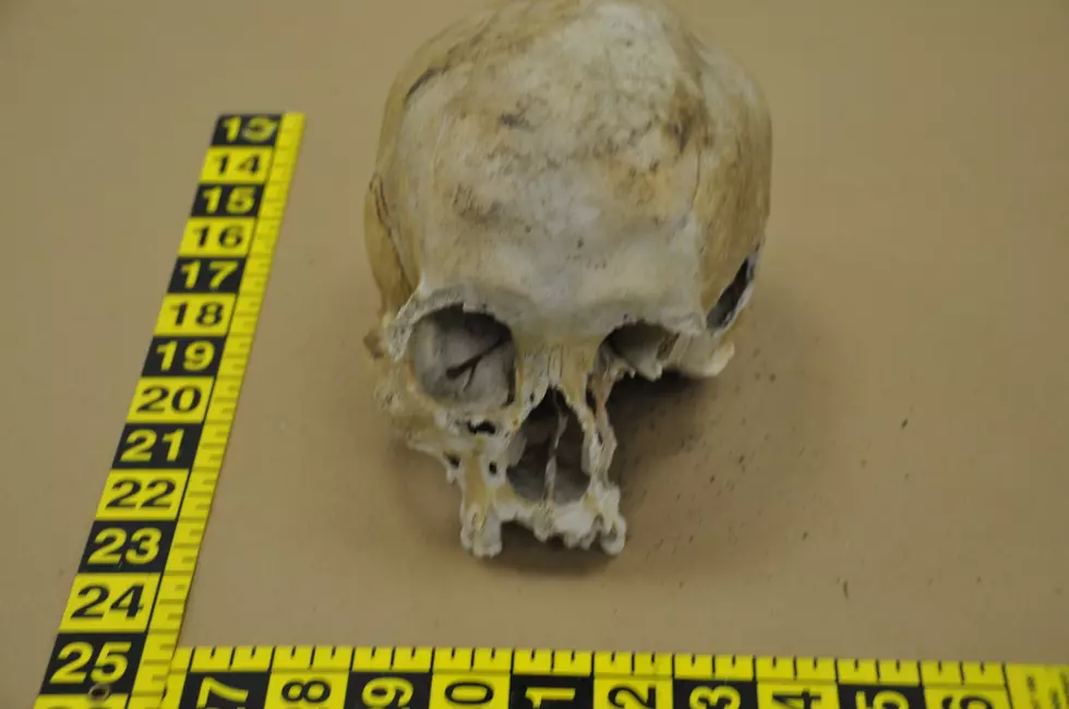 Skull unearthed in Brick Township
