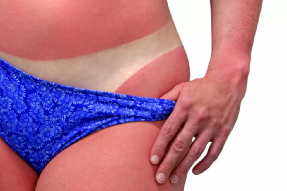 7 Things All Pale People Know