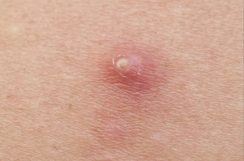 Love Dr. Pimple Popper? We’ve Got the Perfect (Gross) Gift for You