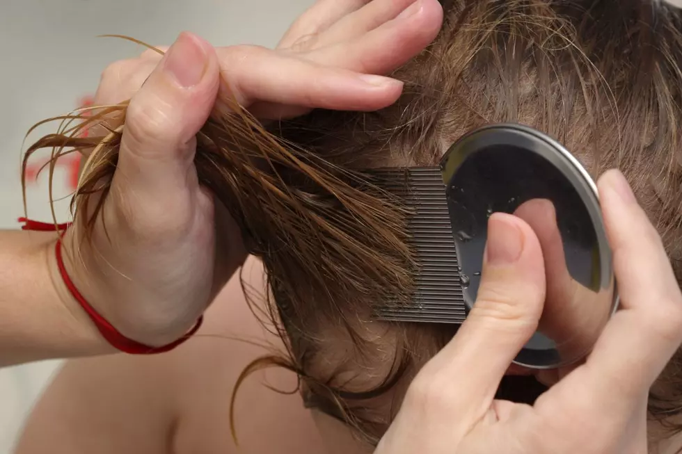 New Guidance Says Kids With Lice Should Not Be Sent Home From School