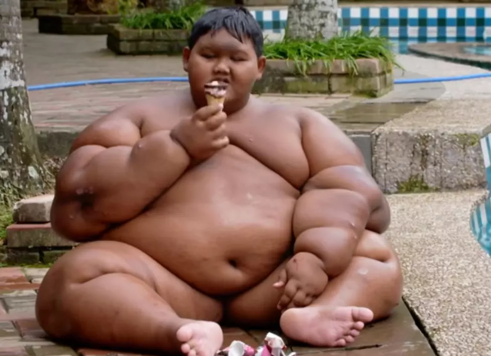 This Is The Heaviest Child In The World
