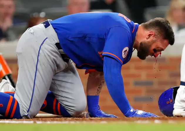 Mets&#8217; Pillar Has Multiple Nasal Fractures After Hit By Pitch
