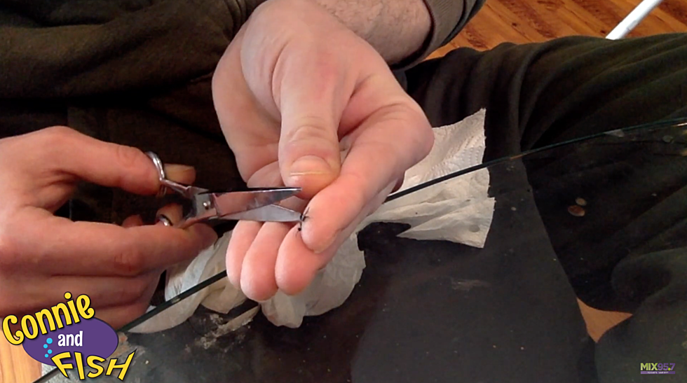 Watch Steven Remove His Stitches [Video]