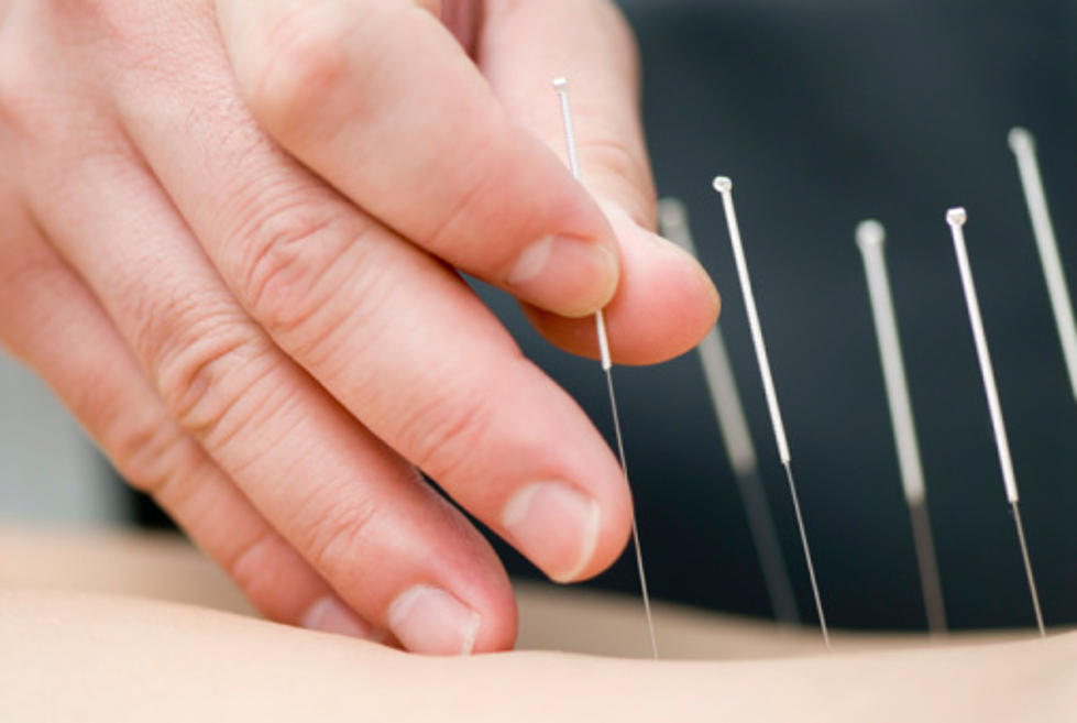 Can Acupuncture Help Migraine Sufferers?