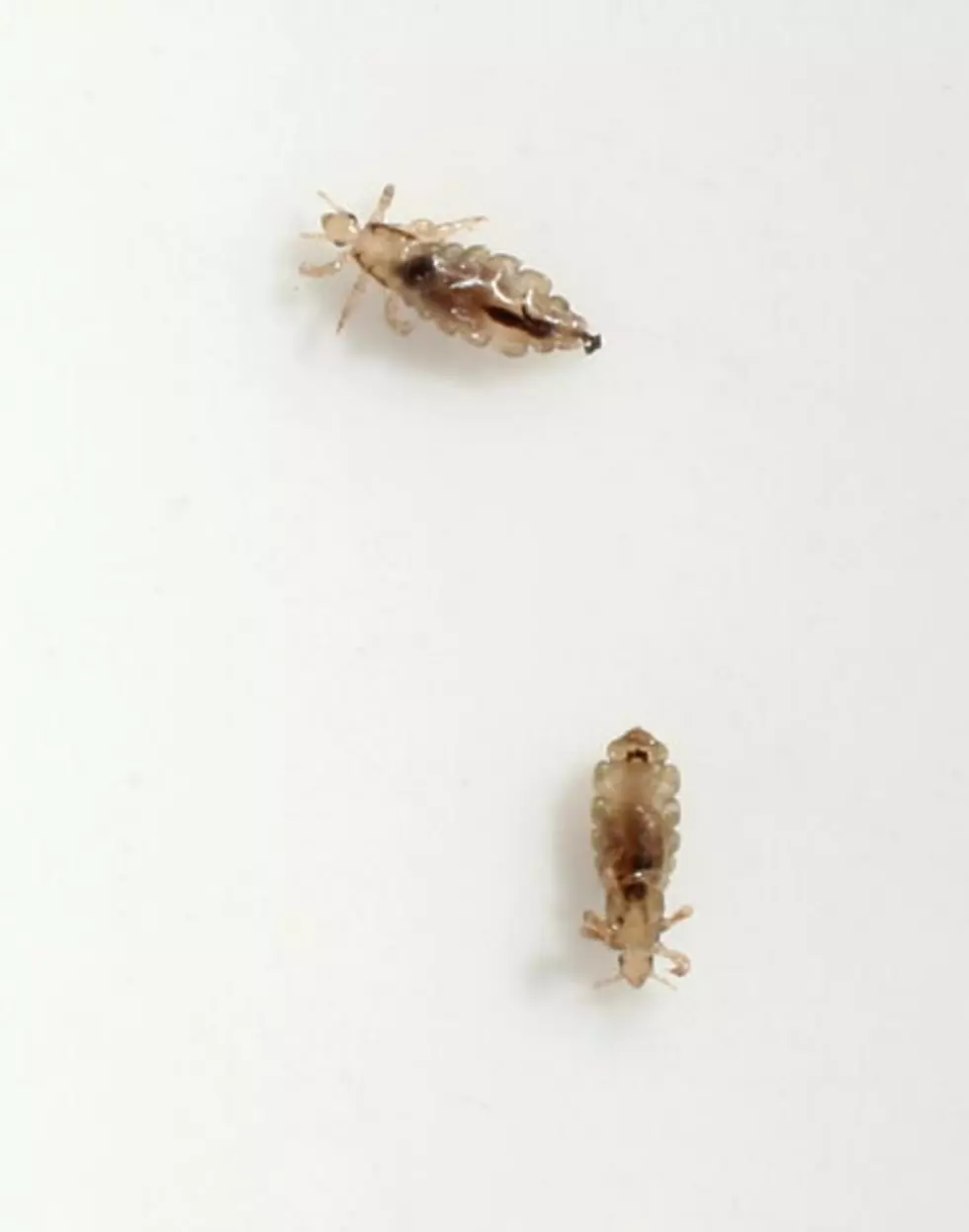 Lice Becoming More Difficult To Fight In America