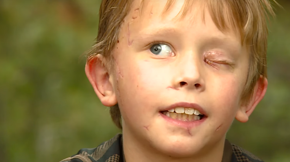 8-Year-Old Colorado Boy Attacked By Mountain Lion Tells The Story