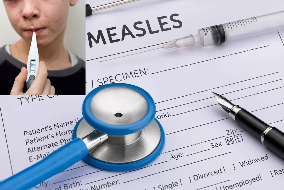 What Sioux Falls Doctors Want Us to Know About A Measles Outbreak