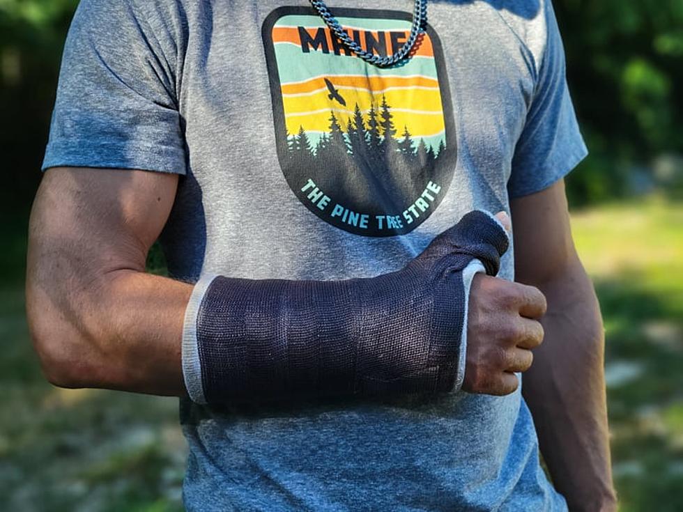 Don't Let A Broken Arm Ruin Your Summer... Buy This!