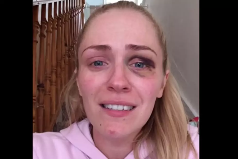 Woman from Ireland Shares Her Story of Physical Abuse [VIDEO]