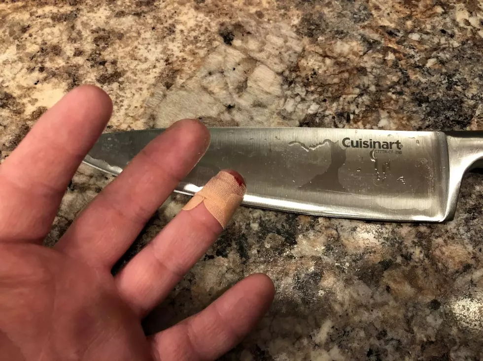 Here's The Ridiculous Way I Managed to Cut Myself on This Knife