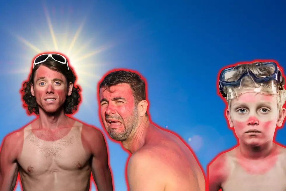 Grand Junction Recalls the Most Painful Sunburn We’ve Ever Had