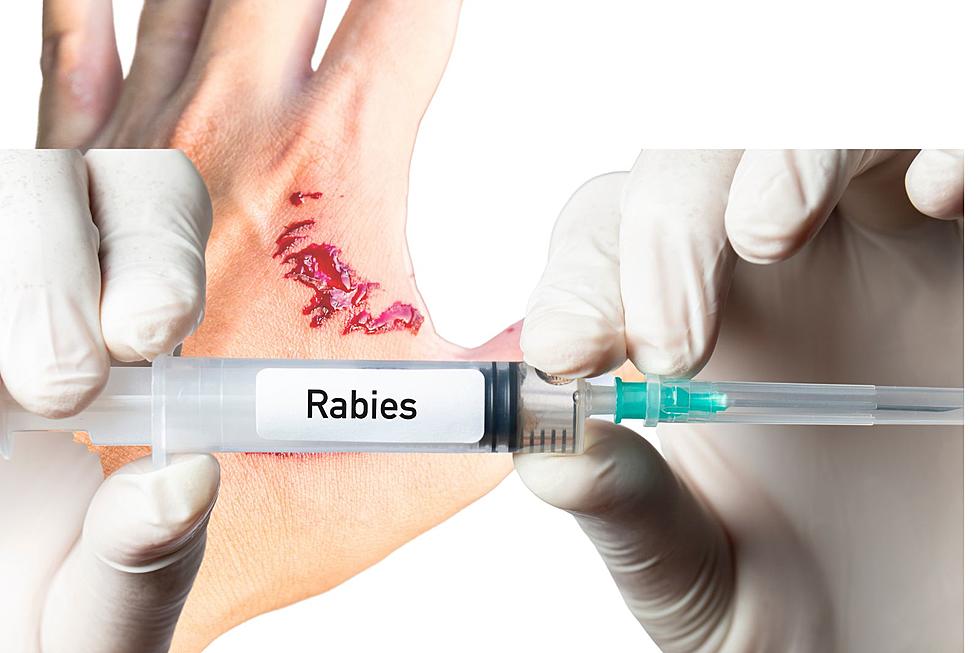 Be Alert! Animal In Texas Test Positive For Rabies, Should You Be Worried?