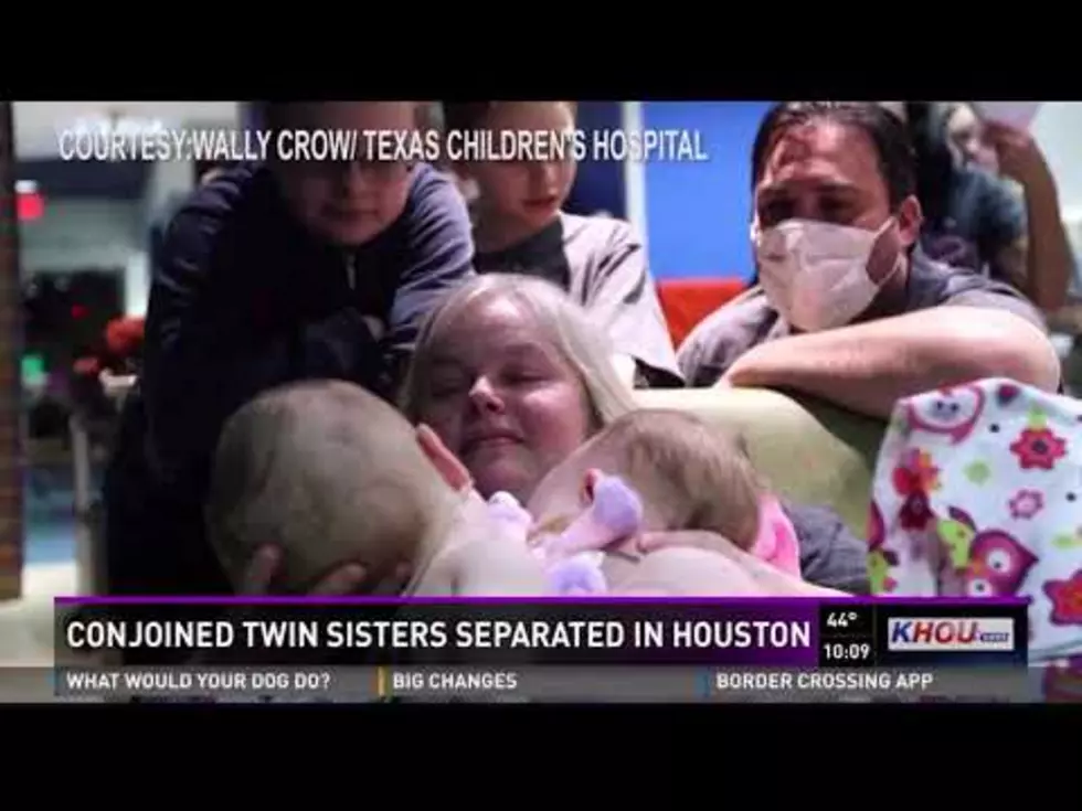 Conjoined Texas Twins Separated in Houston