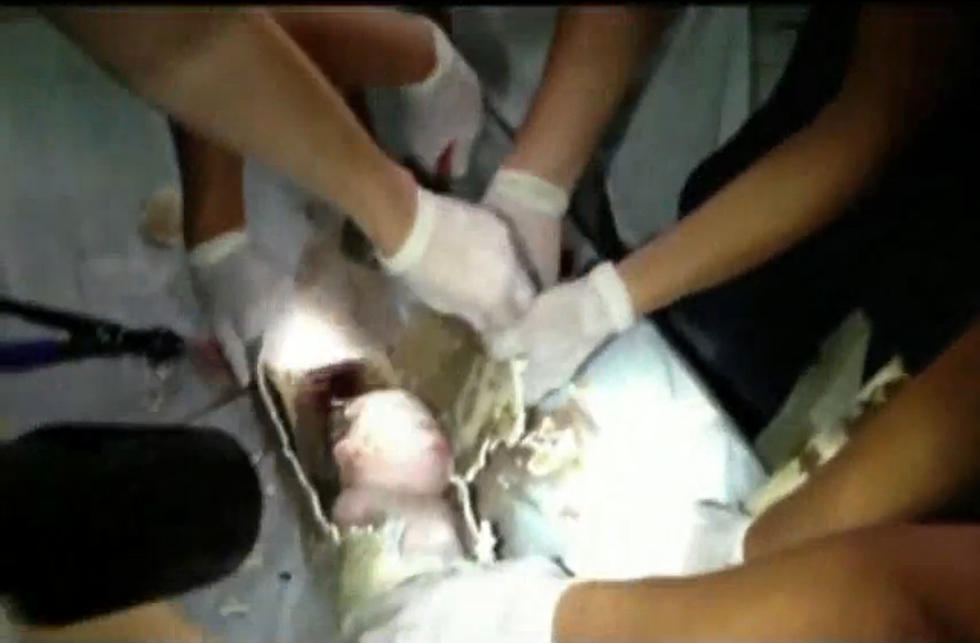 Amazing Story – Newborn Baby Saved From Sewage Pipe In China [VIDEO]