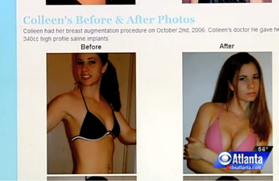 Website Lets Guys Donate Money For Women To Get Breast Implants