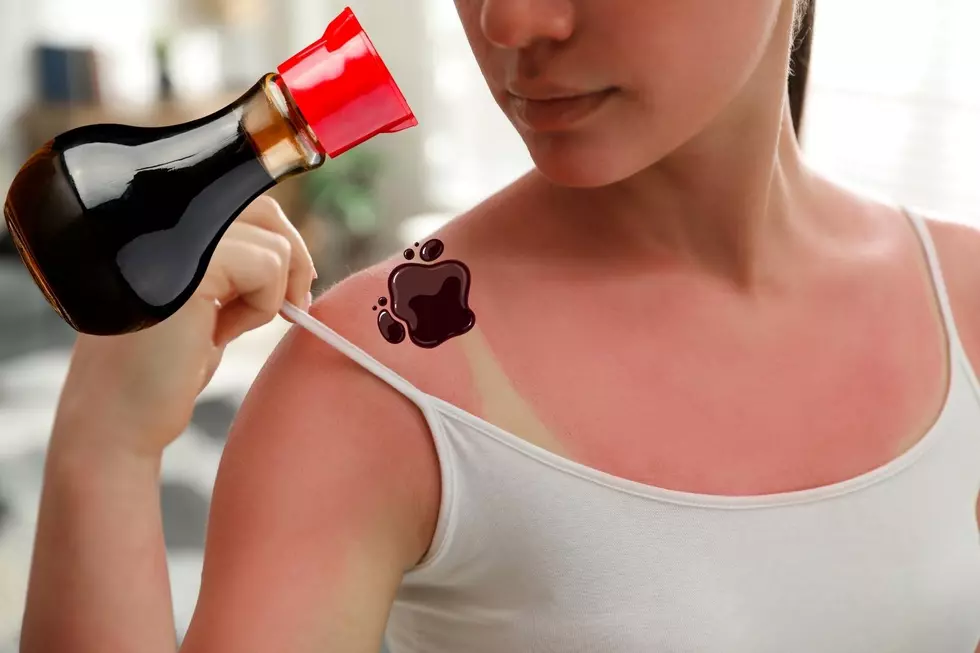 Soy Sauce Relieves Sunburn Pain for Some