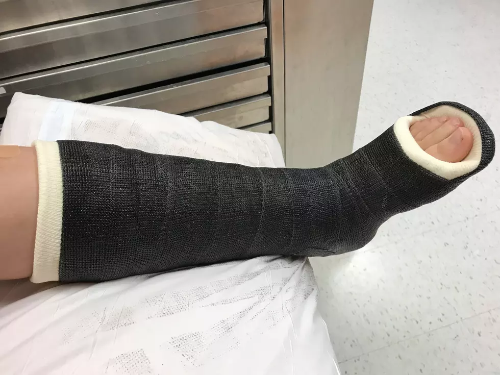 Ever Wonder How Hospitals Remove A Cast On a Leg? [VIDEO]