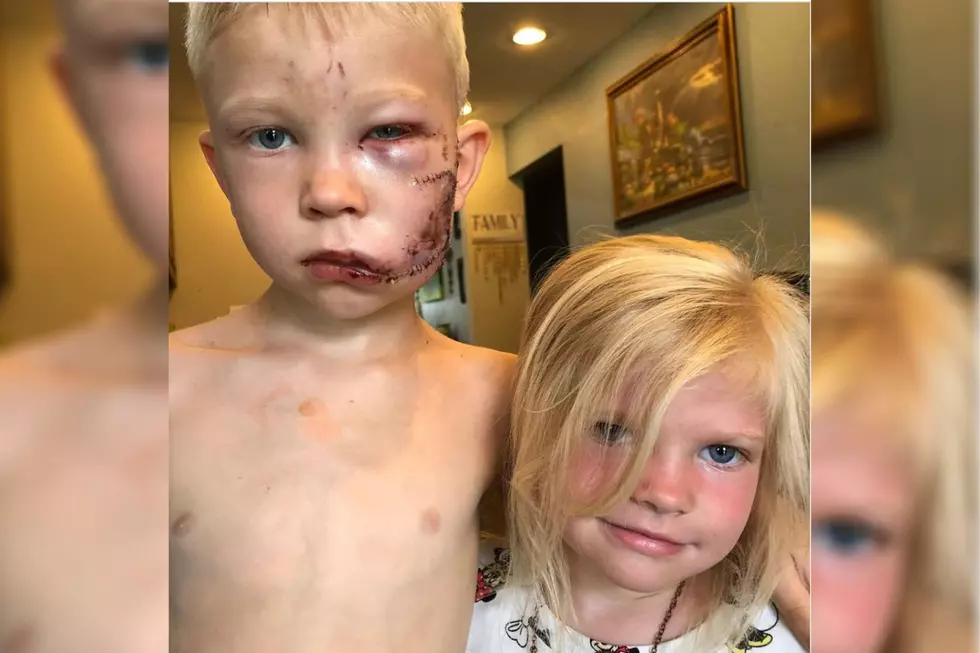 Six-Year-Old Boy Saves Sister from Dog Attack