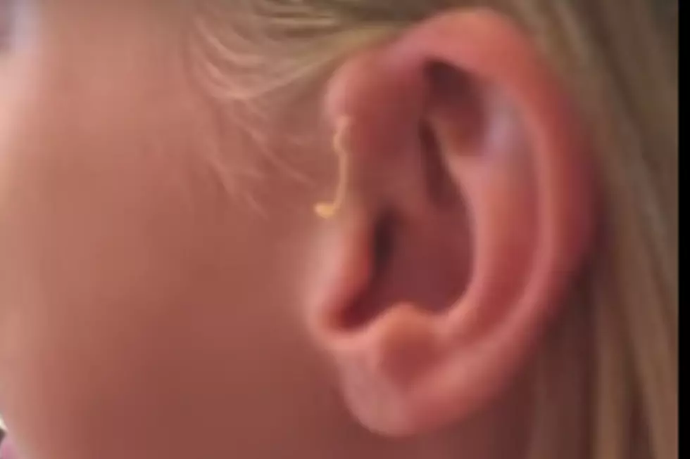 Girl Thinks She Has Scar Tissue For 6 Years-Ends Up Being An Unpopped Zit [VIDEO]