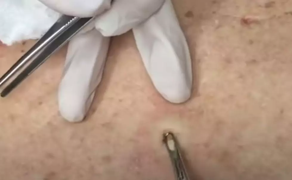 Did You Miss Dr. Pimple Popper’s 4th of July Video?