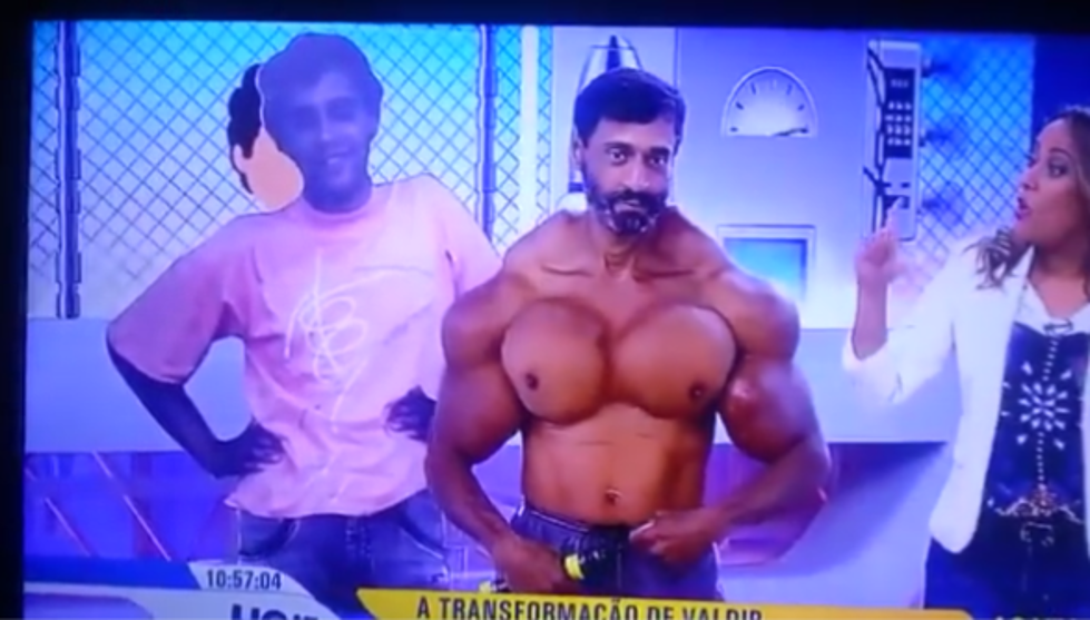 Man Shows off His Crazy Inflated Synthol Injected Muscles