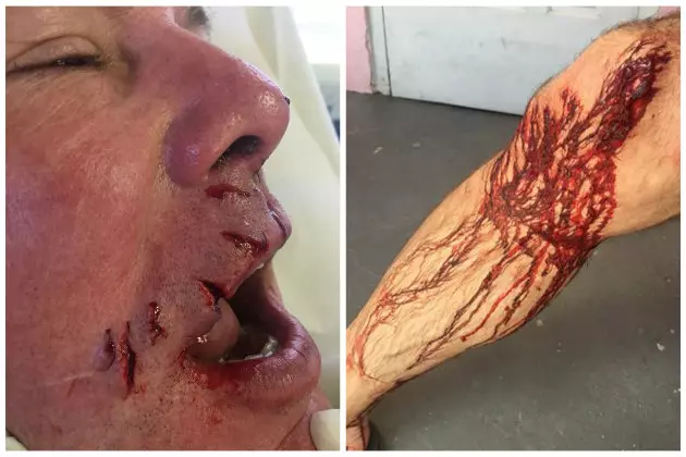 Texas Dentist Survives Shark Attack