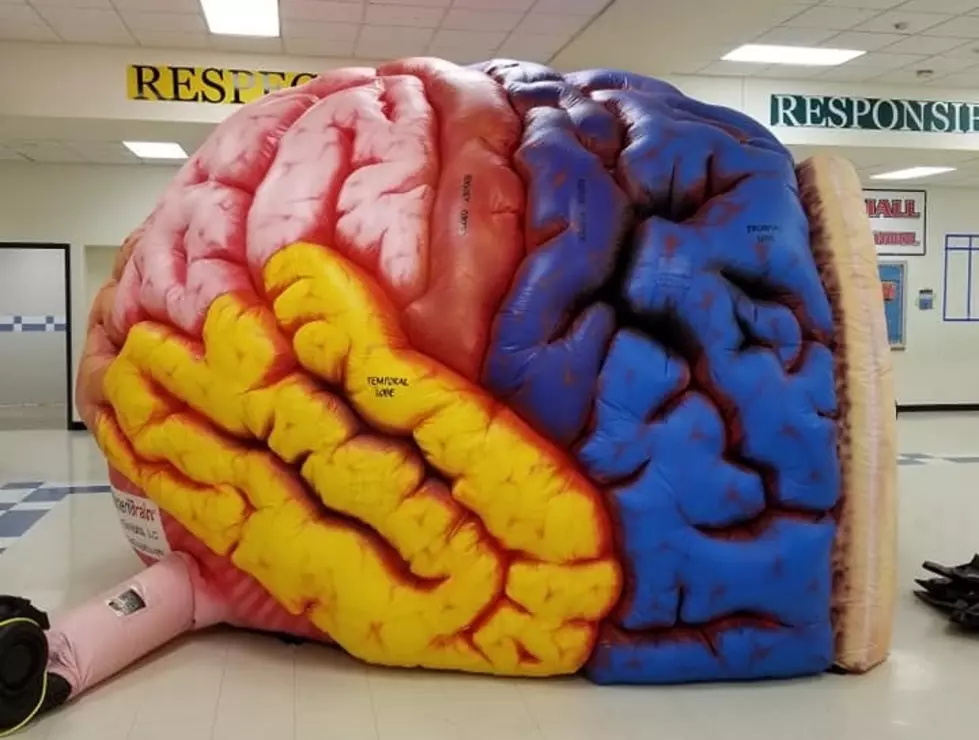 Calhoun County&#8217;s Biggest Brain on Display