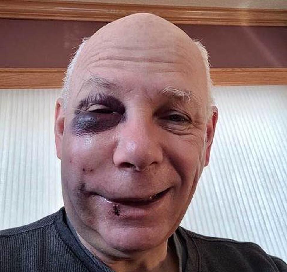Twin Cities Landlord Beaten For Just Doing His Job