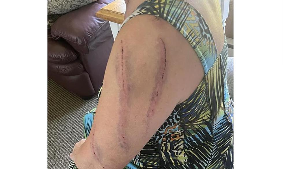 MN Woman Attacked By Bear, Sheriff Releases Injury Picture
