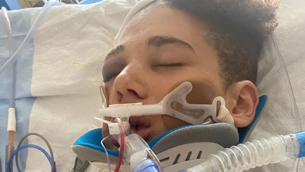 Family Report Rochester Teen Hit by SUV is in Critical Condition