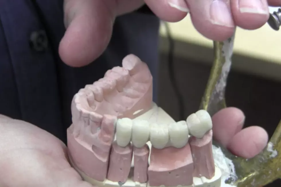 Behind the Scenes: Molding Your Smile At Granite City Dental Lab [VIDEO]