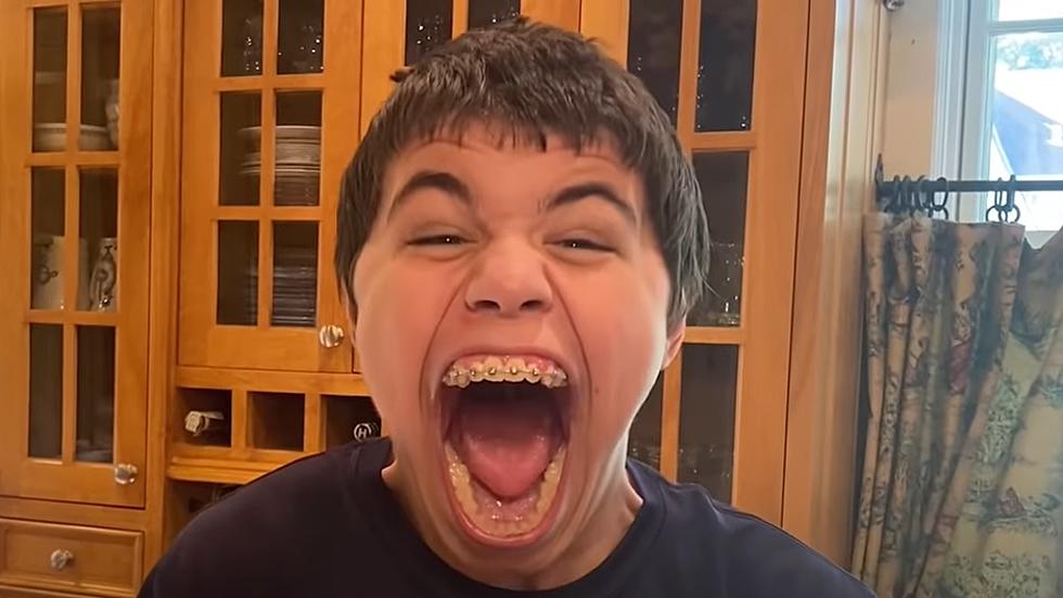 Midwest Teen Breaks the Record for ‘Largest Mouth Gape’ [WATCH]